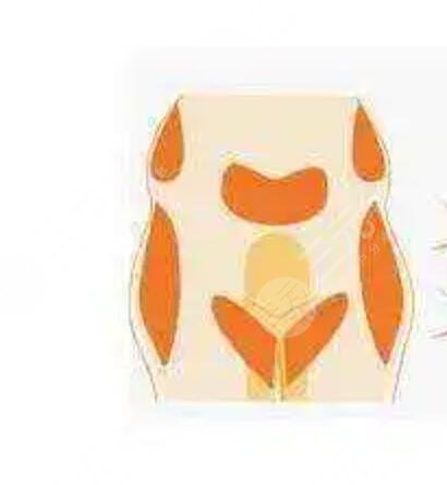 張一鳴個(gè)人資料簡(jiǎn)介，附上玻尿酸填充案例