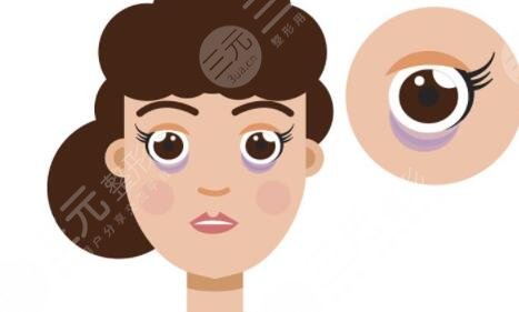 貴州省人民醫(yī)院外切眼袋手術(shù)案例，讓愛美者快速去眼袋