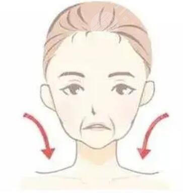非手術面部凹陷填充對比果圖