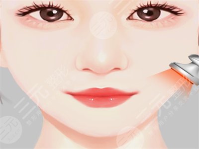 去頰脂墊瘦臉明X嗎？來看真人去頰脂墊瘦臉的手術(shù)過程及恢復(fù)果