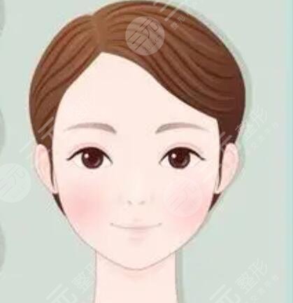雙眼皮案例