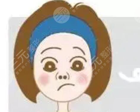 鼻子假體取出恢復狀況展示，真人記錄術后恢復歷程