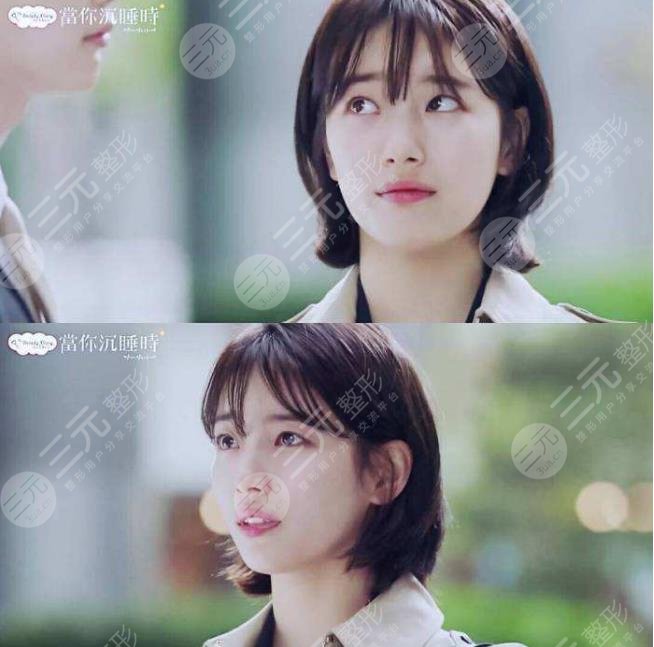 裴秀智微整泡到李敏鎬！從土氣女孩到韓劇女主？她動了哪些地方？