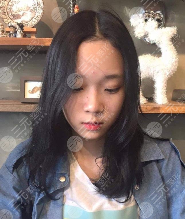 金玟庭winter陷整容風波，她動了哪里?