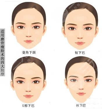 [顴骨整形術(shù)的價格貴不貴?]