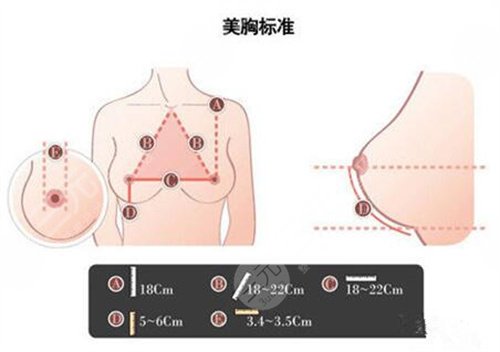 隆胸案例術(shù)前