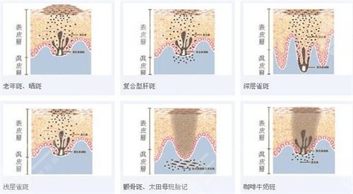 東莞康華醫(yī)院皮膚科收費(fèi)情況
