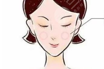蘋果肌