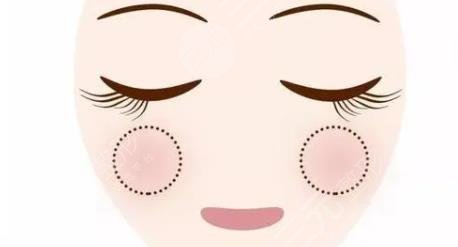 蘋果肌