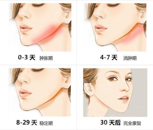 案例對(duì)比圖