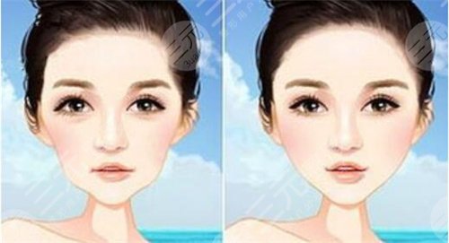 激光嫩膚美白真的有用嗎?