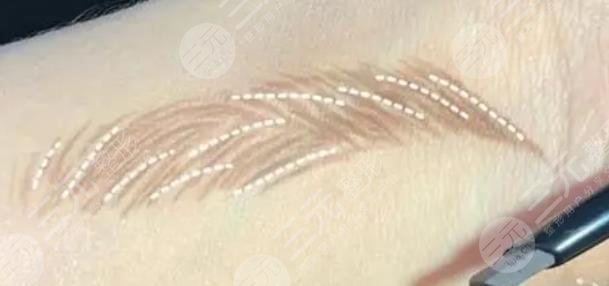 種植眉毛
