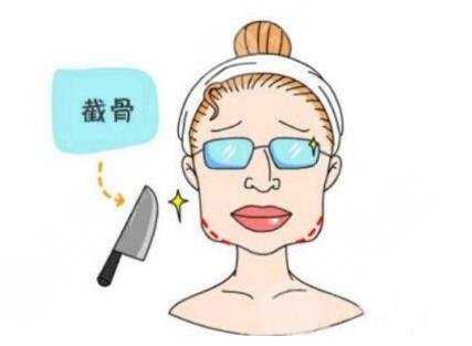 上海華美下頜角真人案例對(duì)比