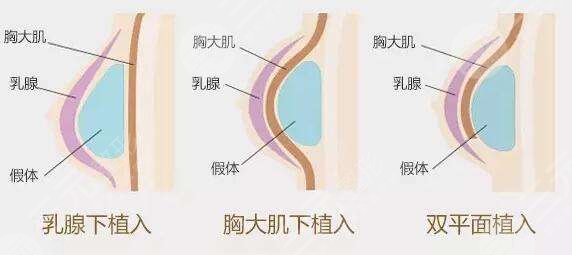 娜綺麗和傲諾拉哪款好？