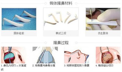 隆鼻子手術(shù)一般需要多少錢?隆鼻方式有哪些？材料有哪些？