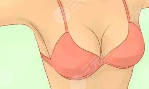 乳暈縮小的有點(diǎn)有哪些?