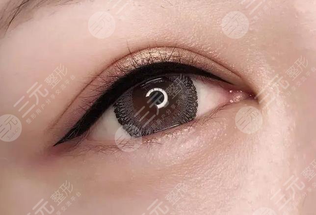 美瞳線(xiàn)一到七天恢復(fù)過(guò)程圖