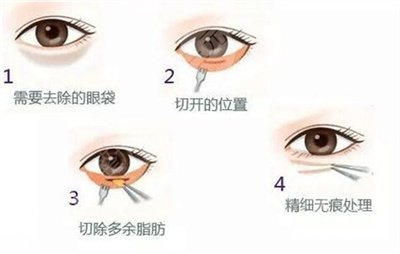 熱瑪吉的緩解次數(shù)一般需要多少次