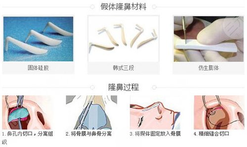 九院王濤隆鼻怎么樣？案例分享丨**改造我的塌鼻子！