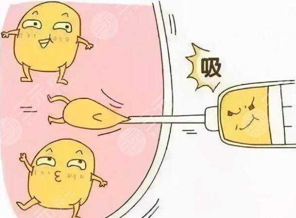 超脂塑吸脂