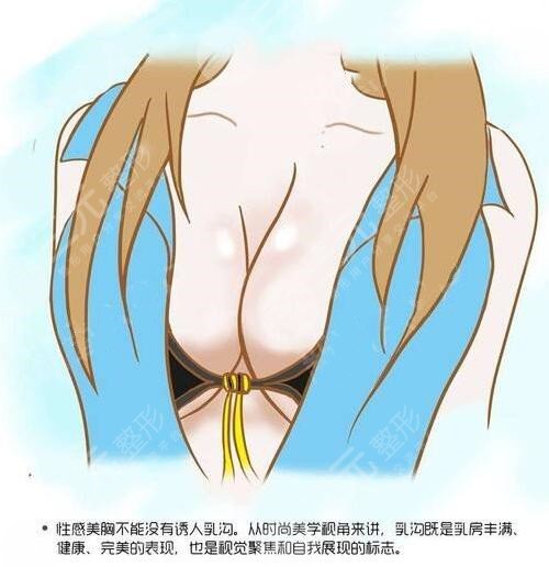 康寧假體和曼托假體哪個好？哪個手感好？康寧假體是國產(chǎn)還是進口？