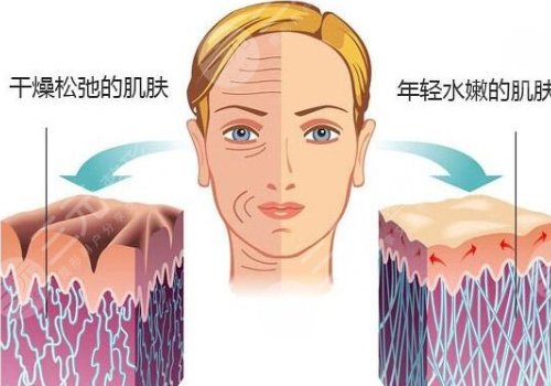 光子嫩膚祛斑果怎么樣？多少錢？?jī)r(jià)格表+禁忌人群+術(shù)后護(hù)理盤點(diǎn)！