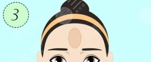額頭填充