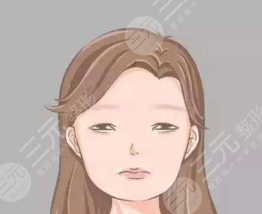 額頭填充