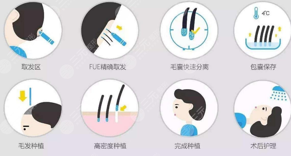 武漢協(xié)和醫(yī)院植發(fā)科開展項(xiàng)目