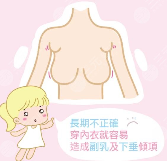切除副乳手術后第五天