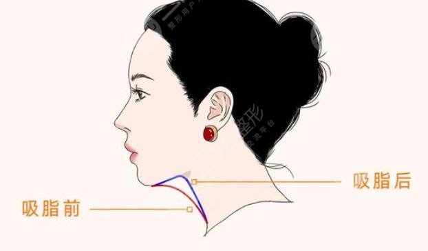 下頜緣