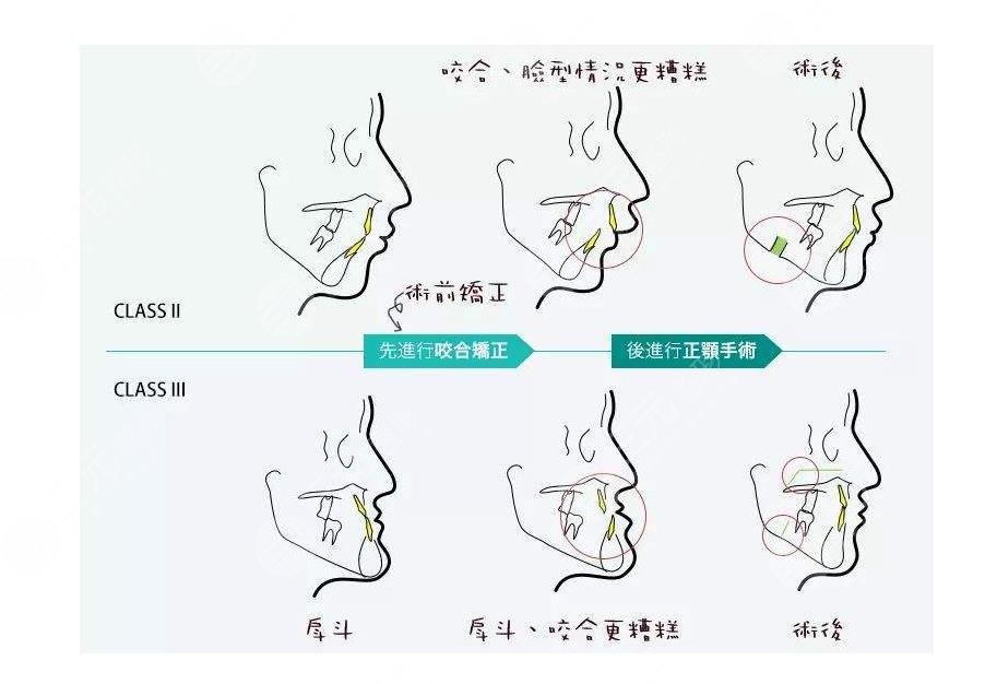 北醫(yī)三院口腔科特色緩解項(xiàng)目、口腔牙齒畸形矯正