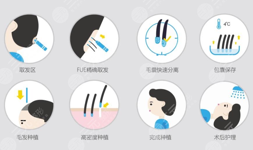 長沙新茂醫(yī)學(xué)植發(fā)手術(shù)過程體驗案例分享