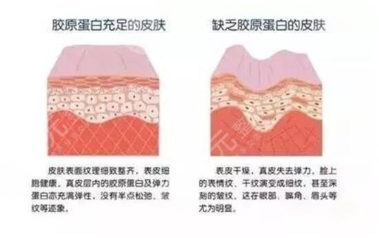膠原蛋白豐蘋(píng)果肌果好不好