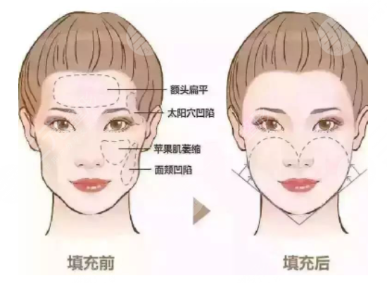 外形不佳