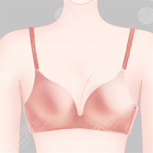 乳暈漂紅價格是多少？乳暈漂紅價格解密！
