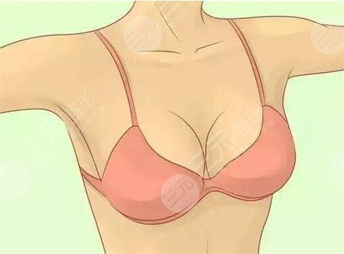 乳暈漂紅價格是多少？乳暈漂紅價格解密！