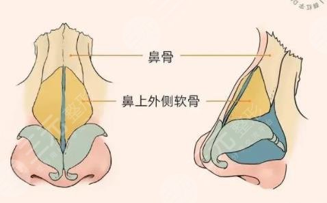 鼻修復