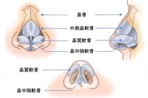 鼻修復