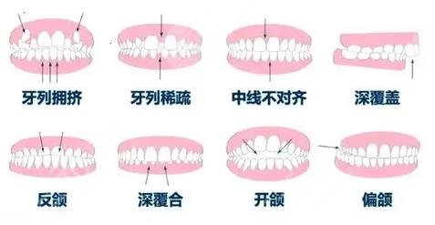 口腔問(wèn)題