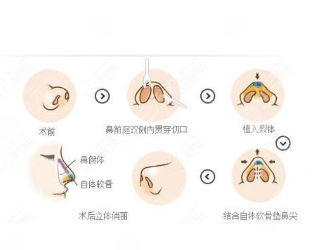 網(wǎng)友案例分享  術(shù)前