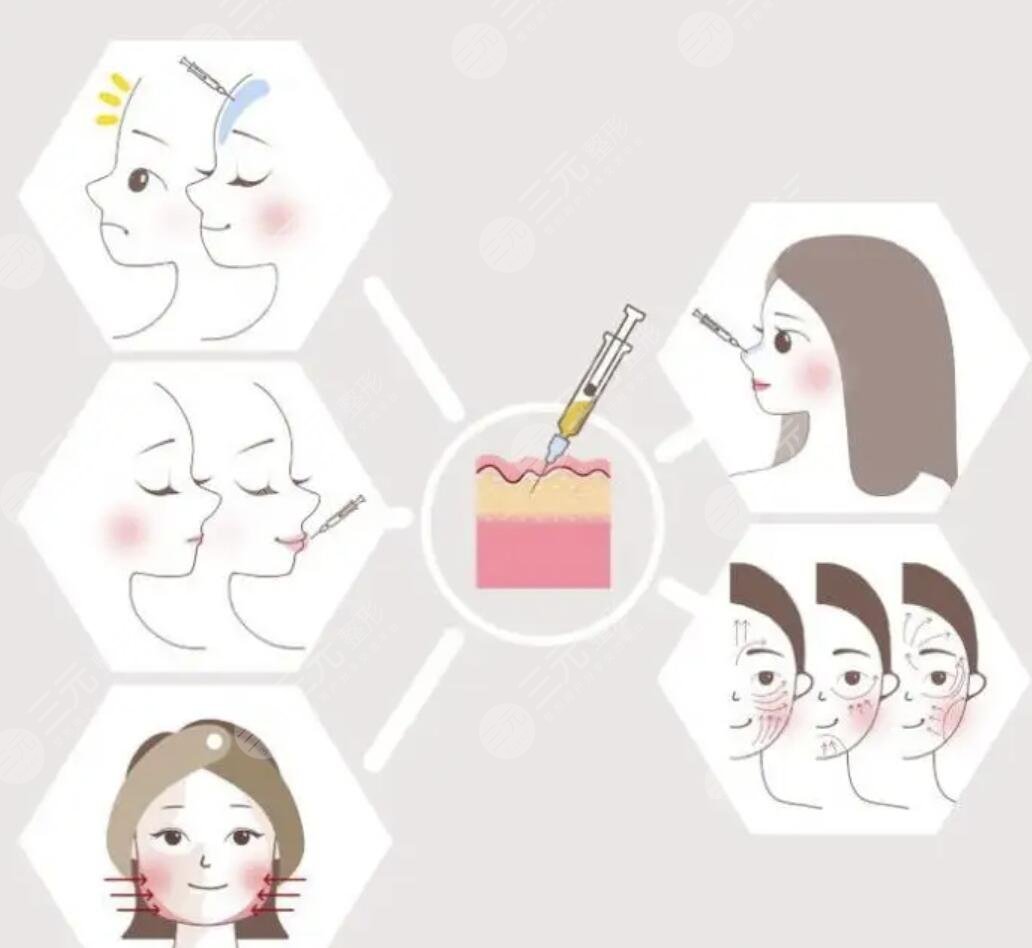 *玻尿酸注射后如何養(yǎng)護(hù)皮膚果維持時(shí)間長(zhǎng)？