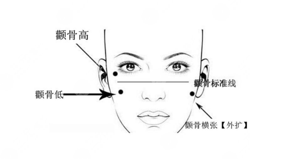 顴骨高太陽(yáng)凹陷自己怎么改良?