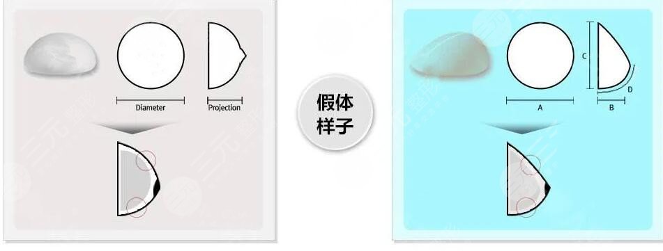 進口曼托隆胸多少價格