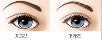 案例|全切雙眼皮一個(gè)星期恢復(fù)圖:弧度流暢自然