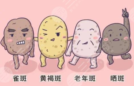 彩光祛斑會反彈嗎?
