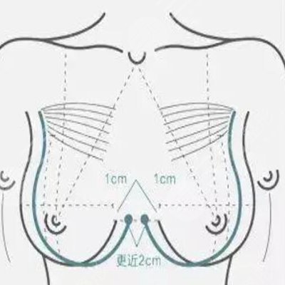 乳暈漂紅做一次就行嗎?果怎么樣？多少錢？