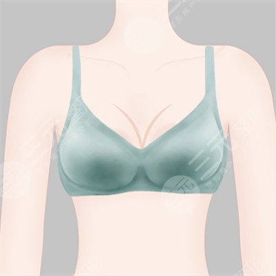 乳暈漂紅做一次就行嗎?果怎么樣？多少錢？