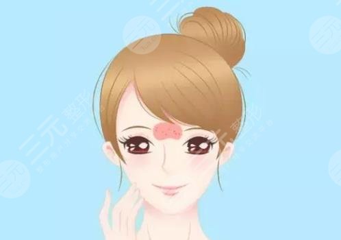 額頭長(zhǎng)痘