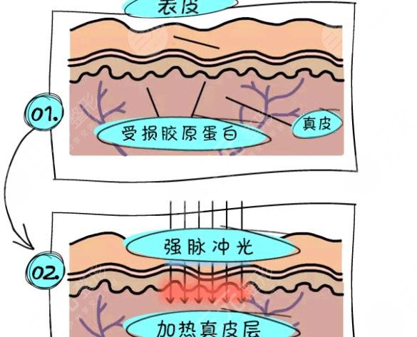 軍訓(xùn)后如何快速美白？